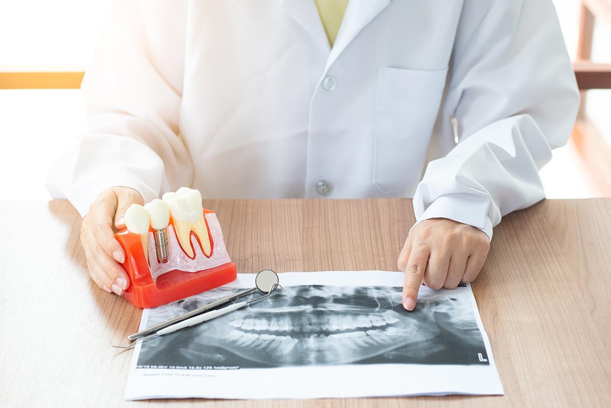 Qui peut être implanté ?