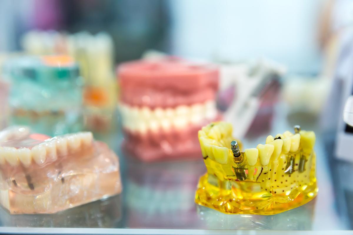 Le traitement par implants est-il une procédure douloureuse ?
